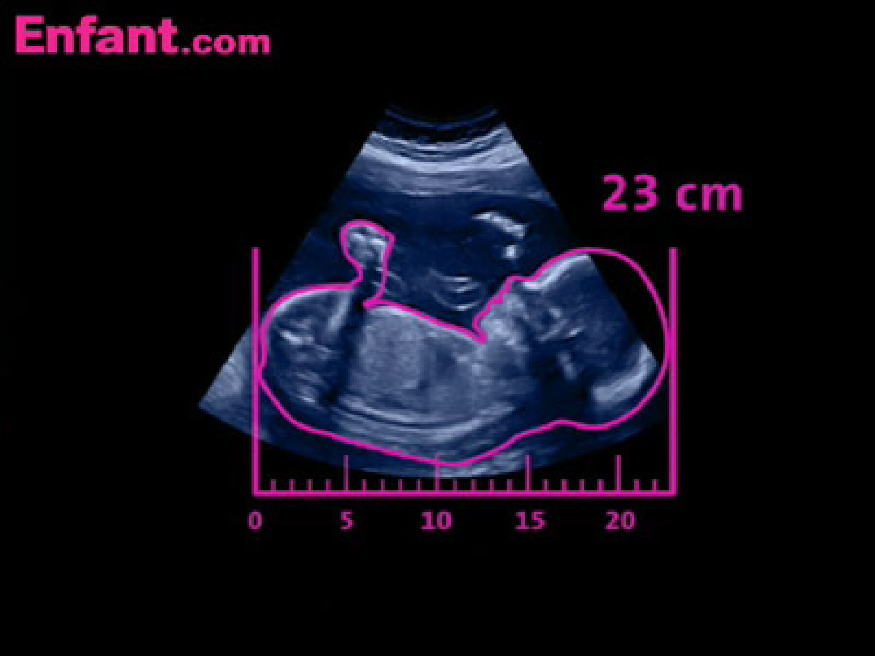 9 mois in utero en vidéos