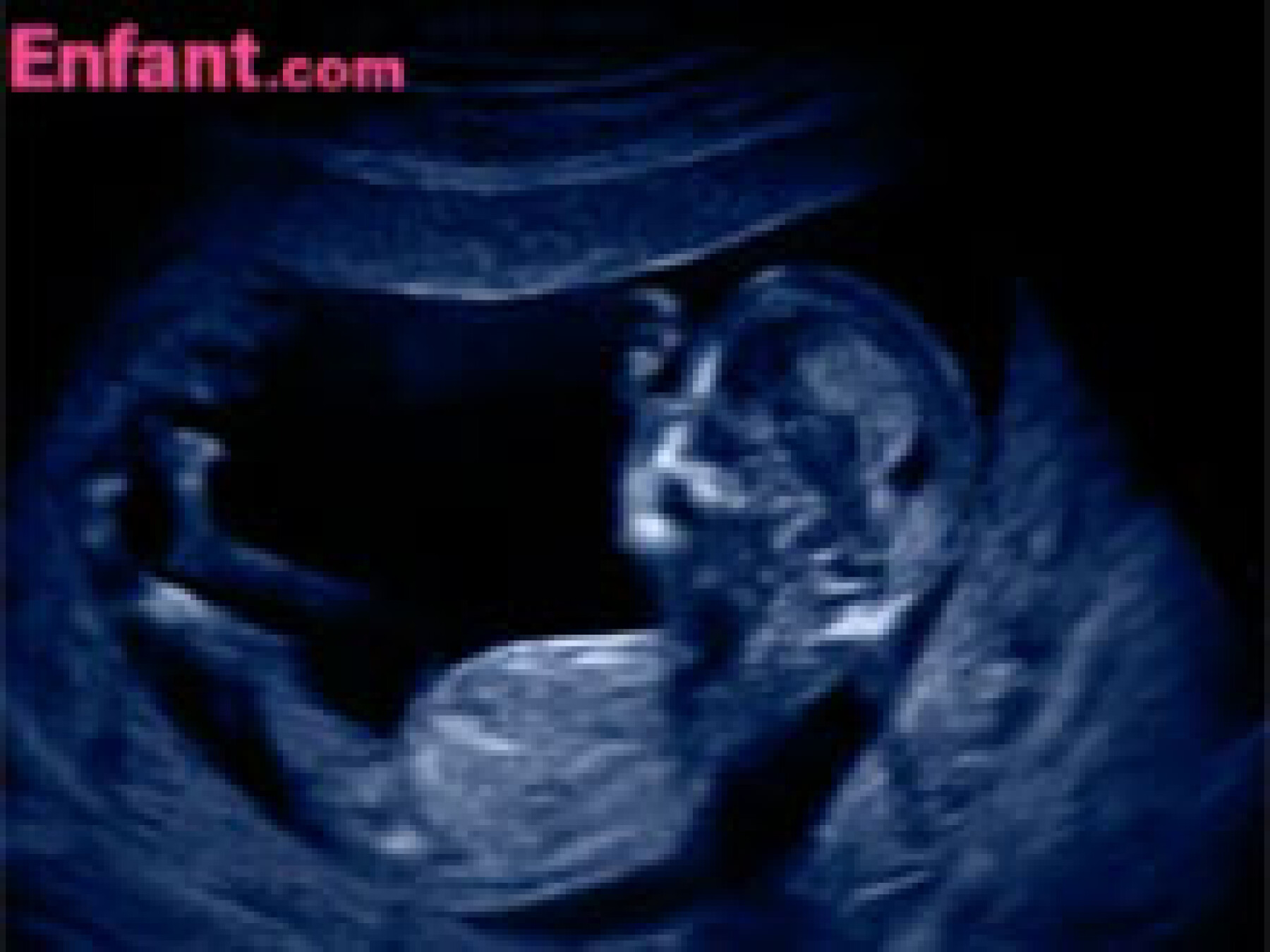 3e mois in utero