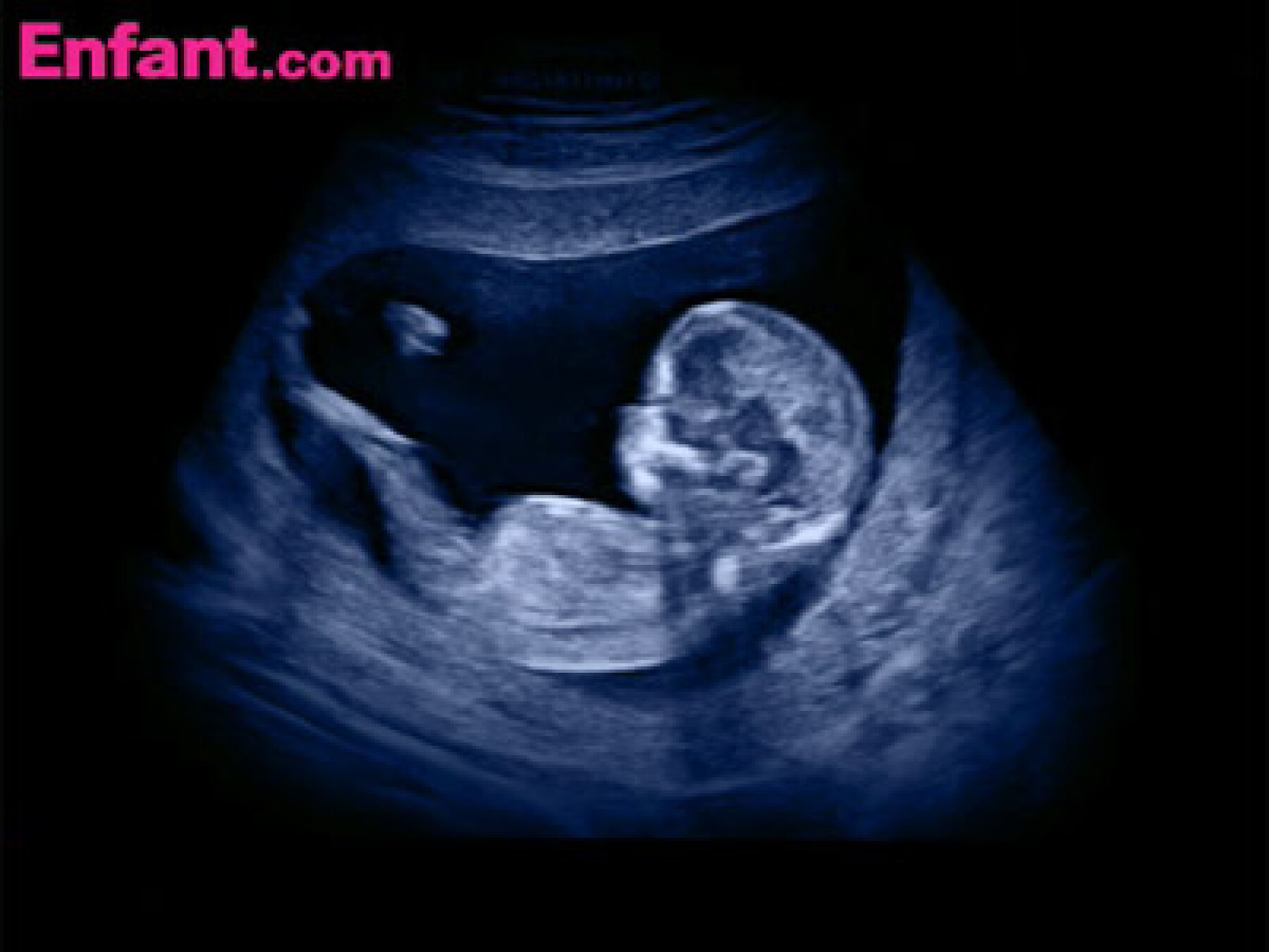 Voyage in utero : le 1er trimestre