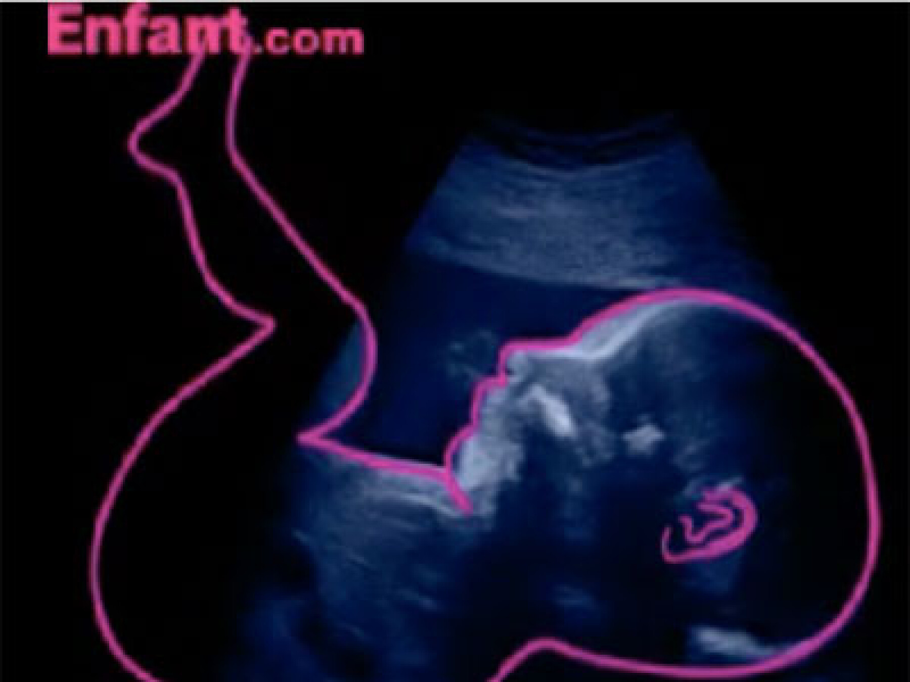 6e mois in utero