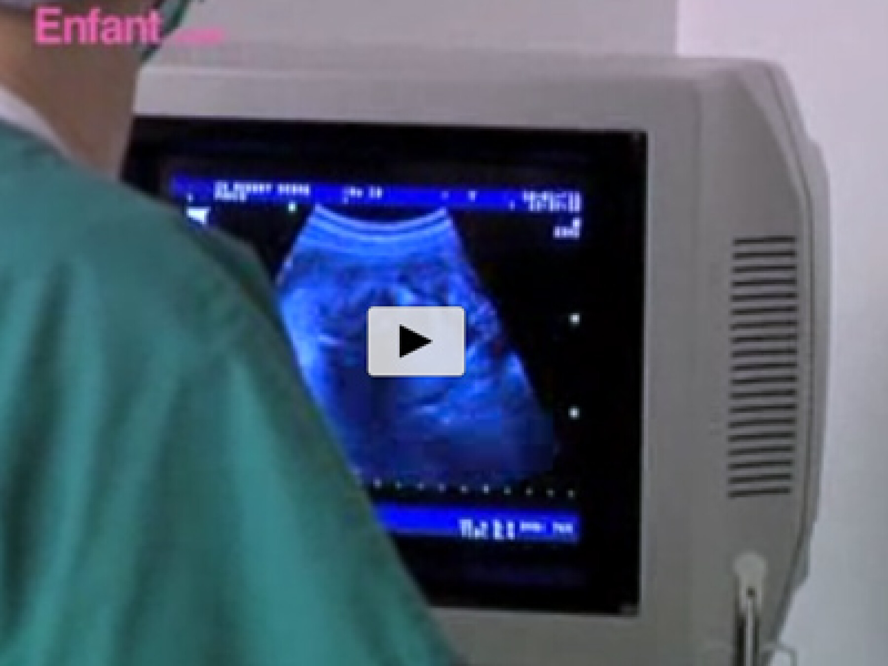 amniocentese video