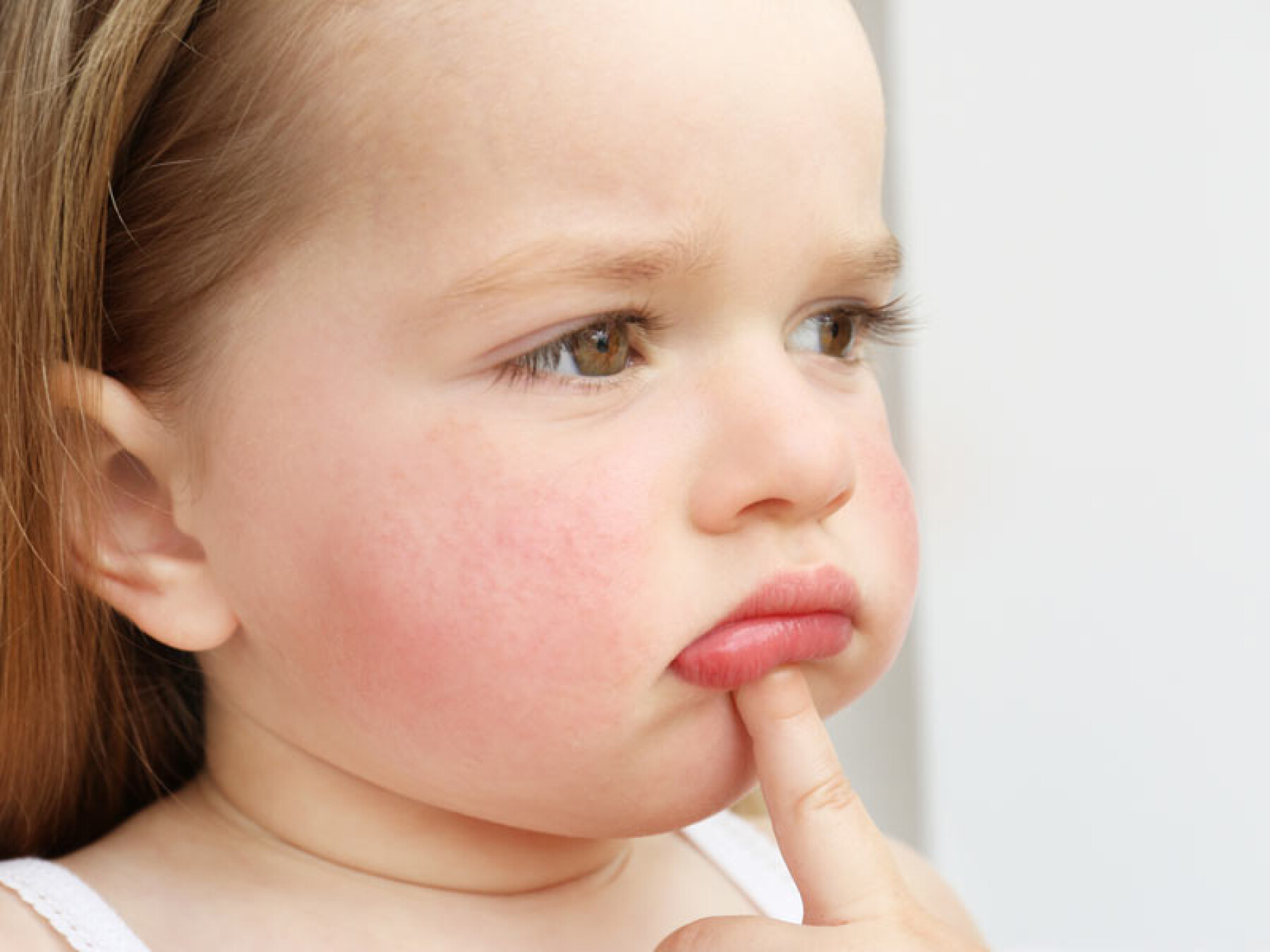 Impetigo Attention A La Contagion