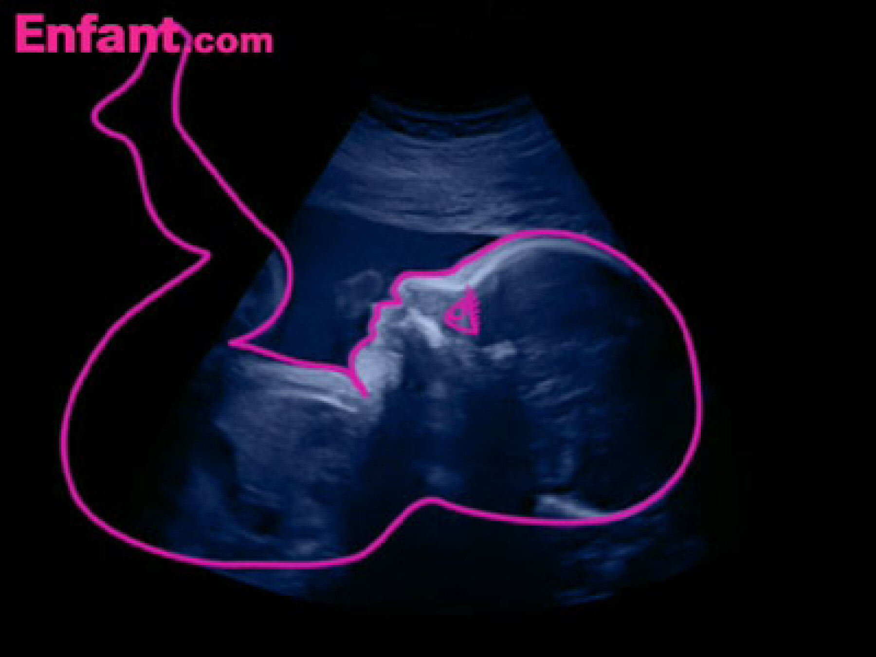 Voyage in utero : le 6e mois