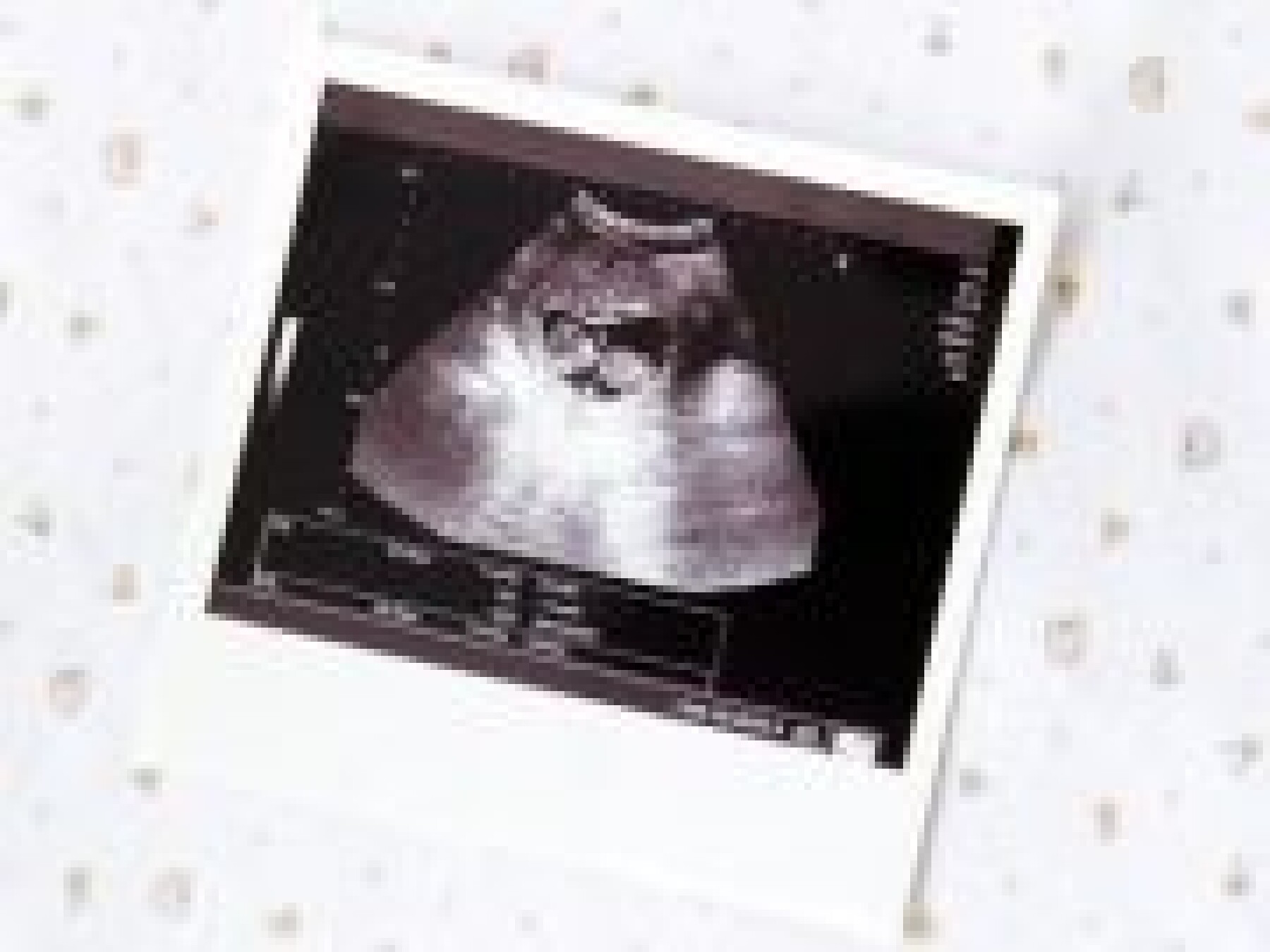 video 3e mois in utero